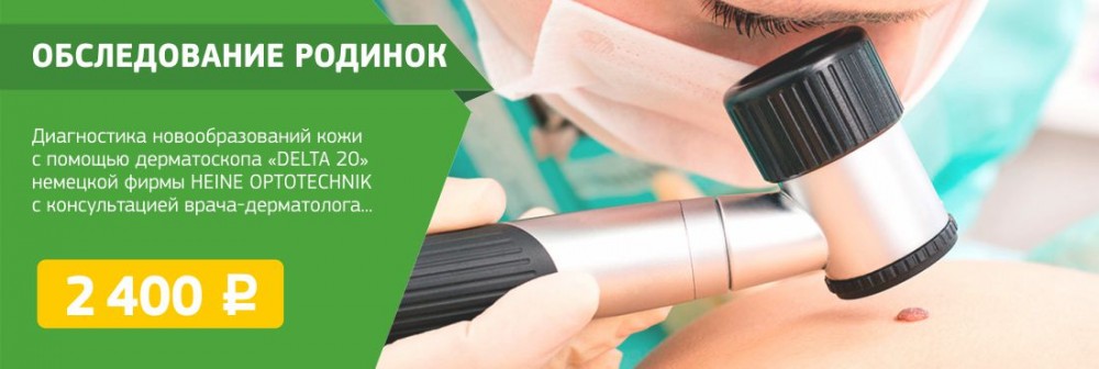Обследование родинок