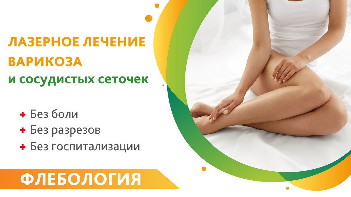 Лазерное лечение варикоза и и сосудистых сеточек